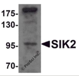 Western blot analysis of SIK2 in SW480 cell lysate with SIK2 antibody at 1 μg/mL.