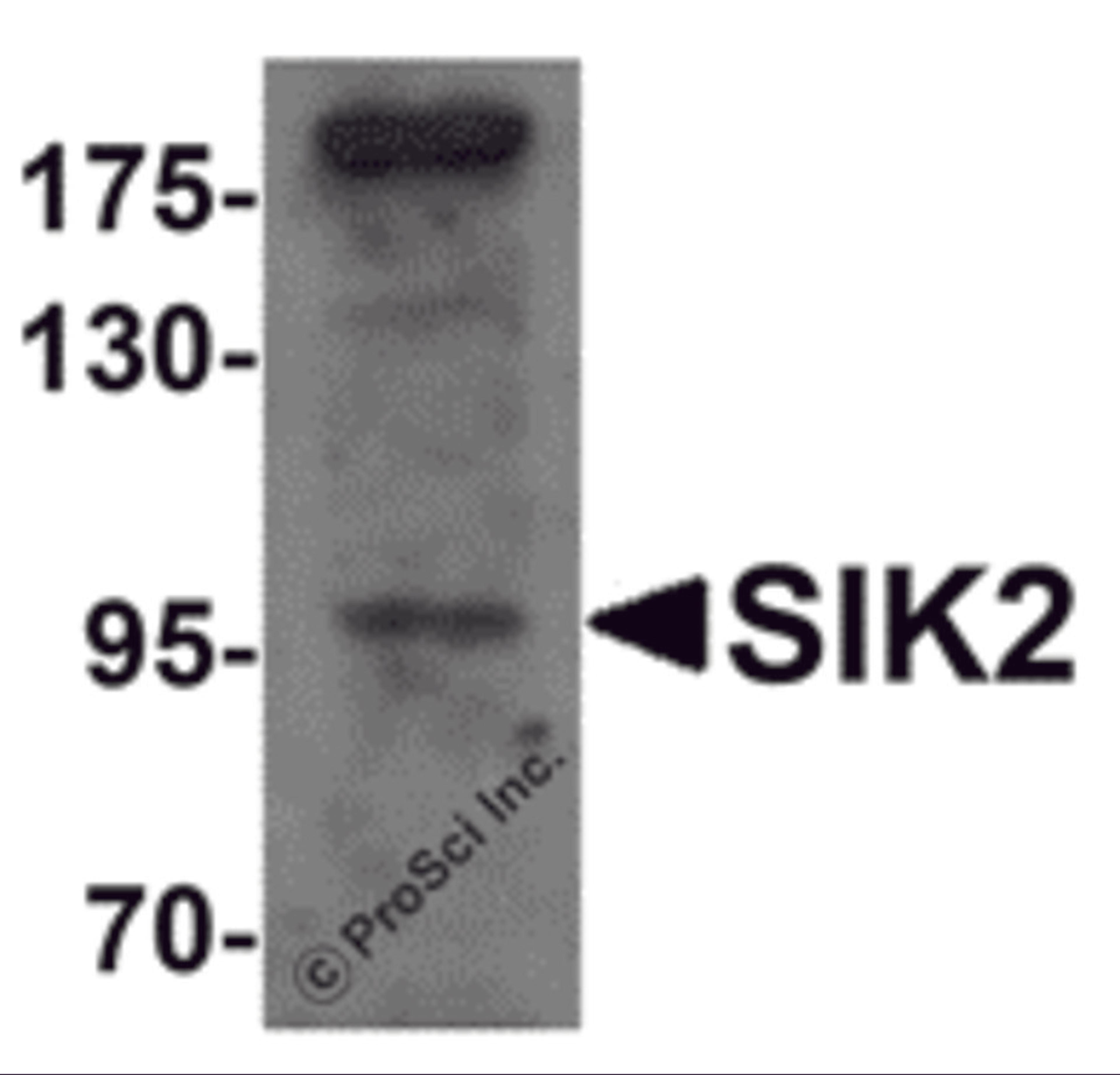 Western blot analysis of SIK2 in SW480 cell lysate with SIK2 antibody at 1 μg/mL.