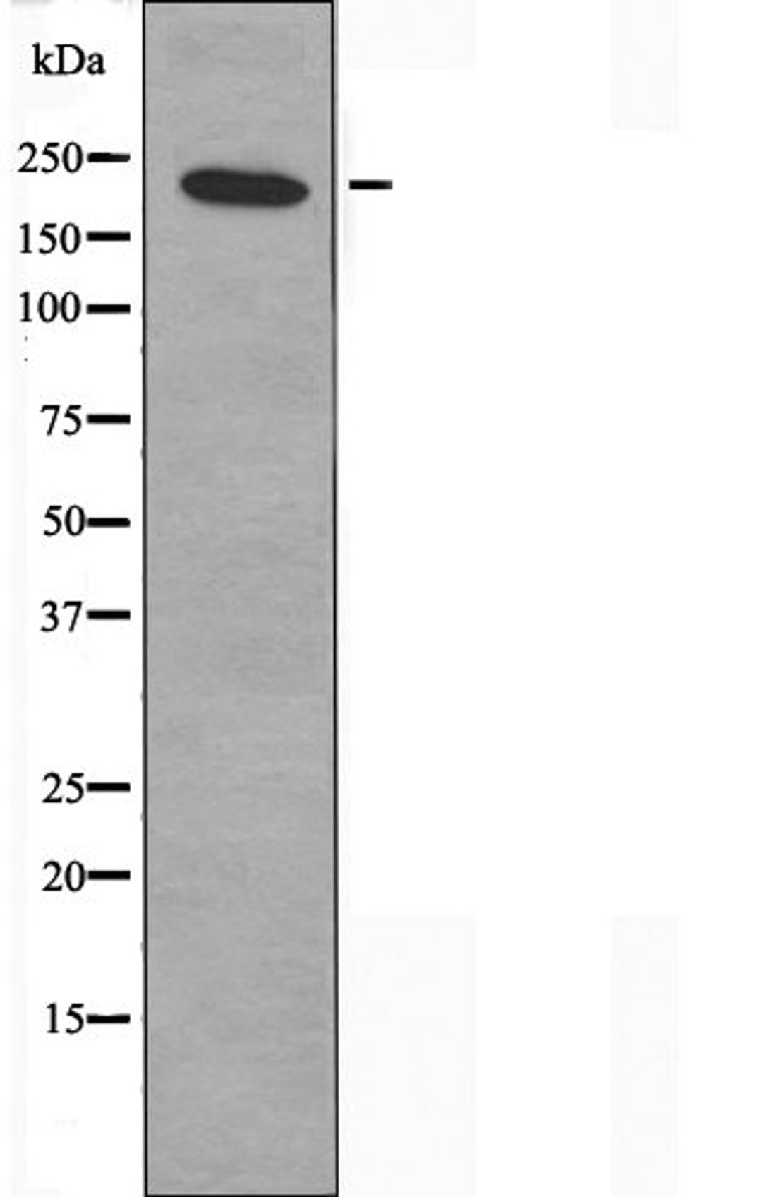 Western blot analysis of K562 cells using MYH15 antibody