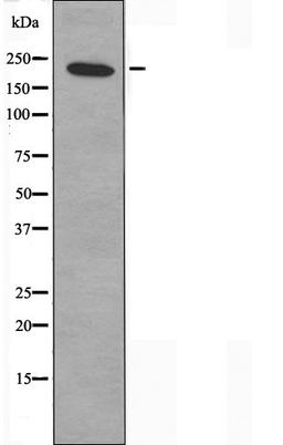 Western blot analysis of K562 cells using MYH15 antibody