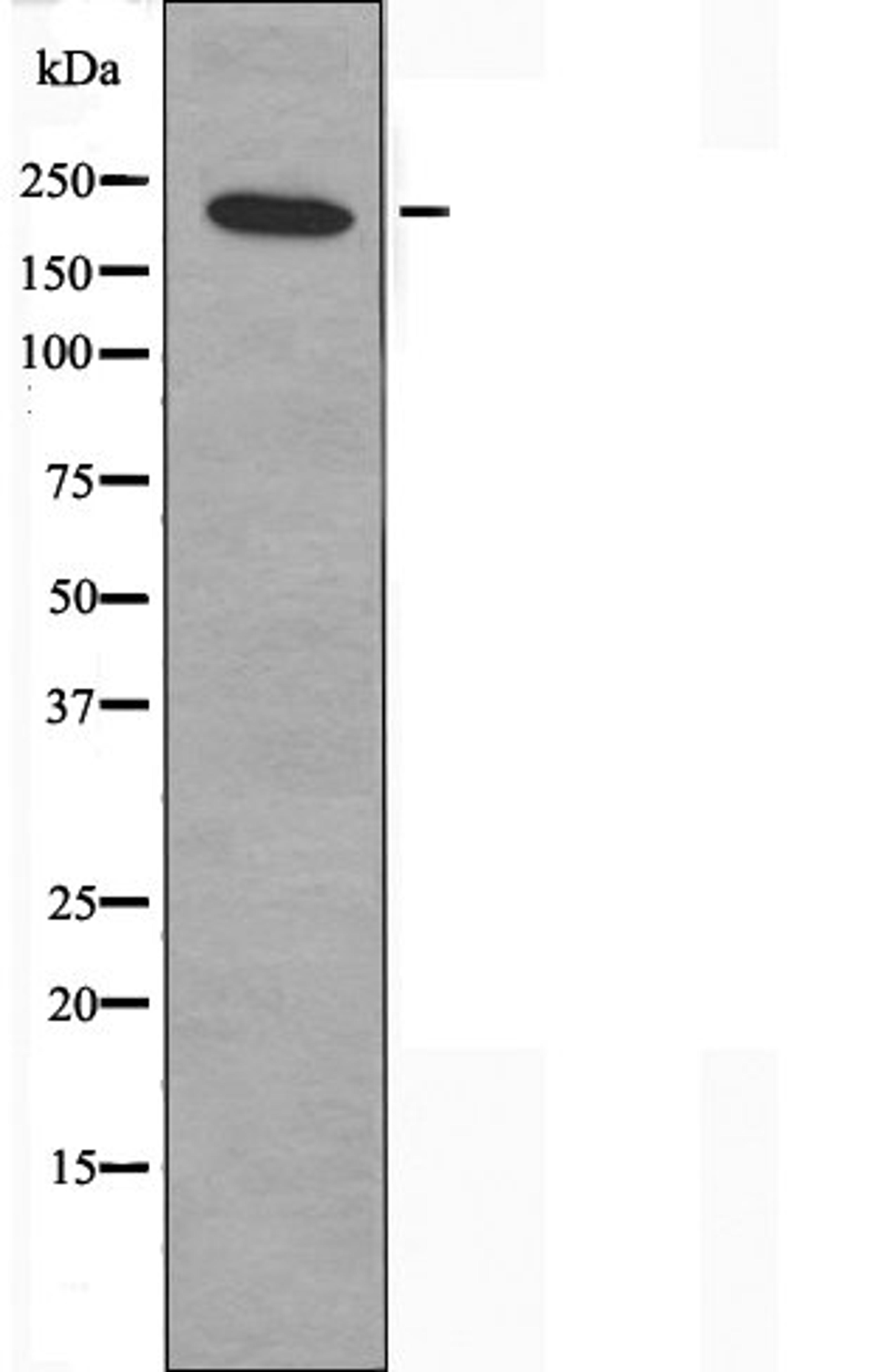 Western blot analysis of K562 cells using MYH15 antibody