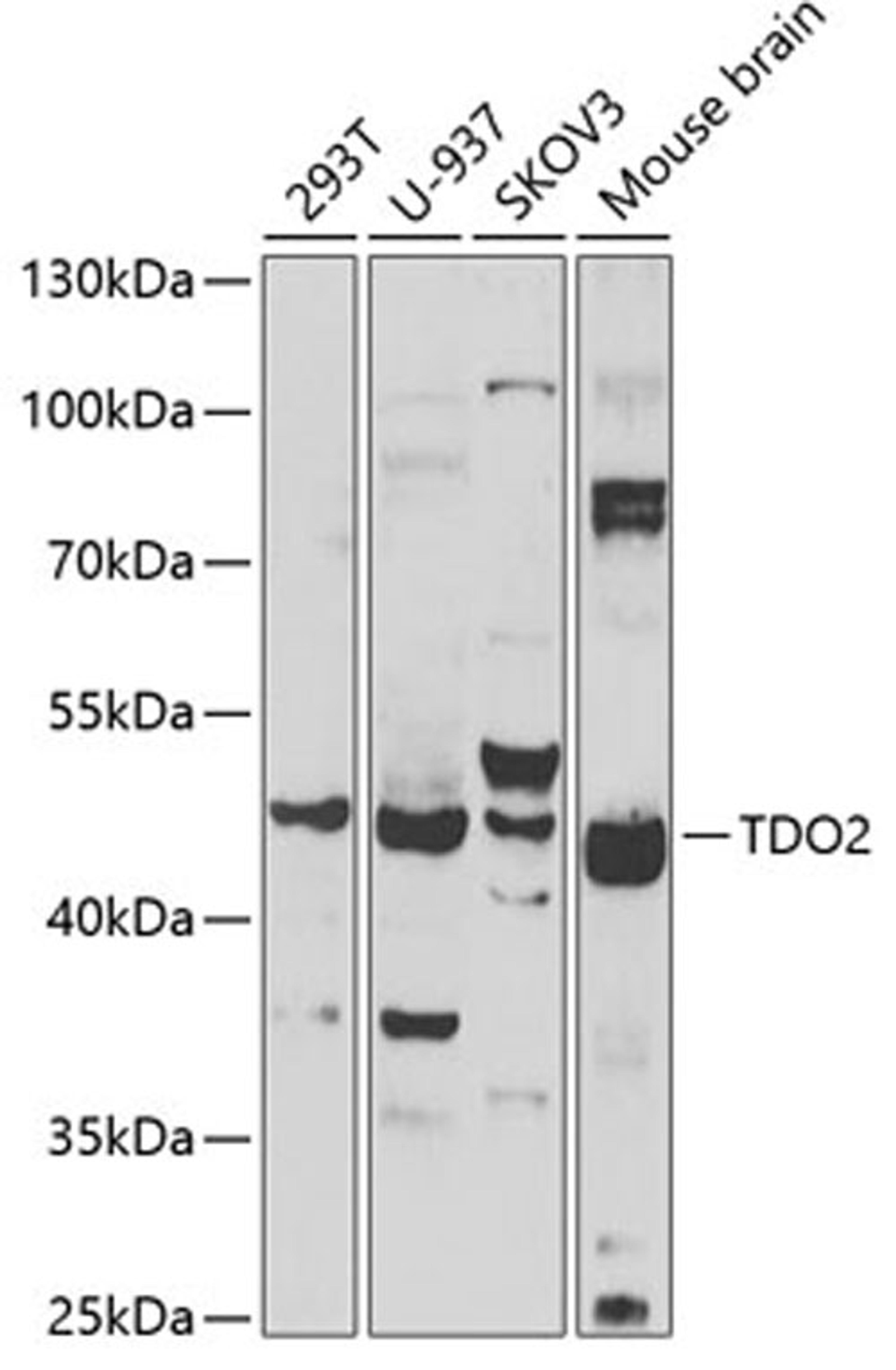 Western blot - TDO2 antibody (A6766)