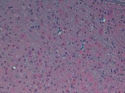 Immunohistochemistry: Melatonin Receptor 1B Antibody [NLS932] - Analysis of Human Brain using Fast Red with hematoxylin counterstain.