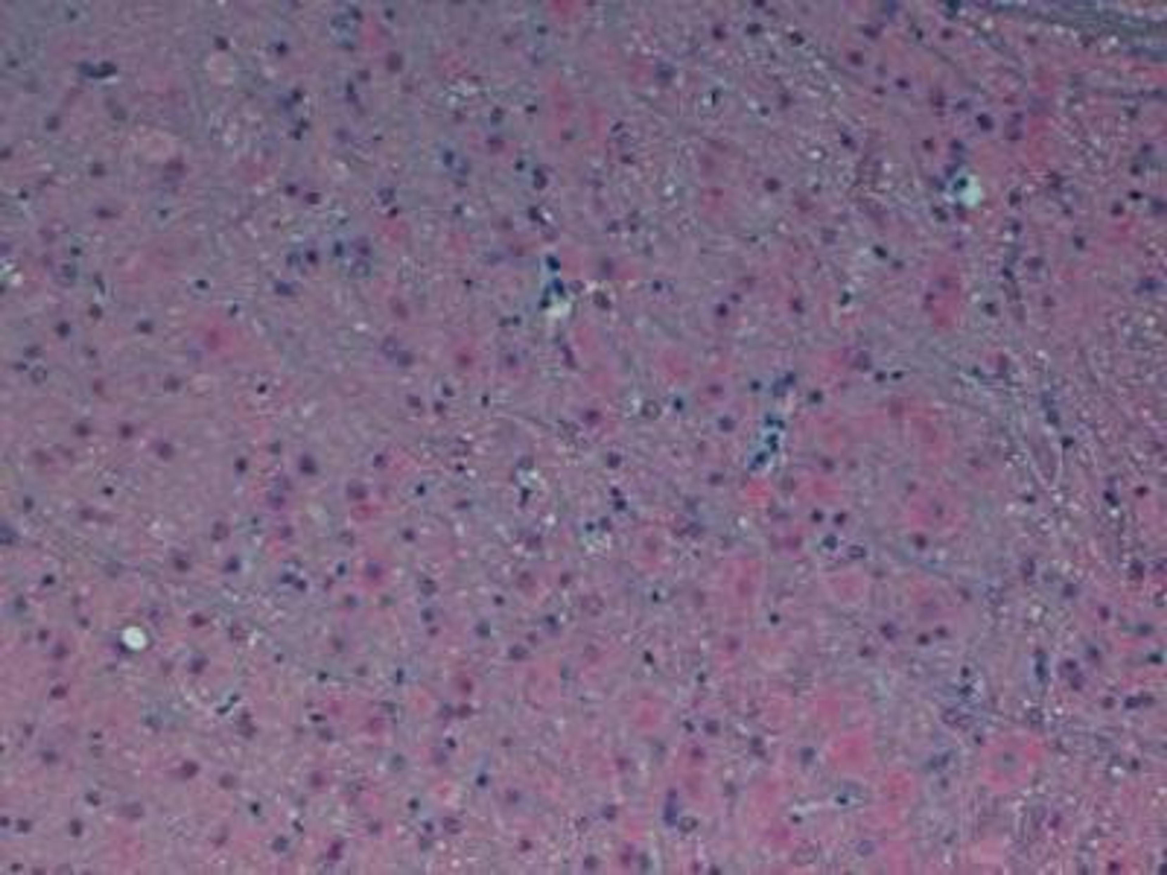 Immunohistochemistry: Melatonin Receptor 1B Antibody [NLS932] - Analysis of Human Brain using Fast Red with hematoxylin counterstain.