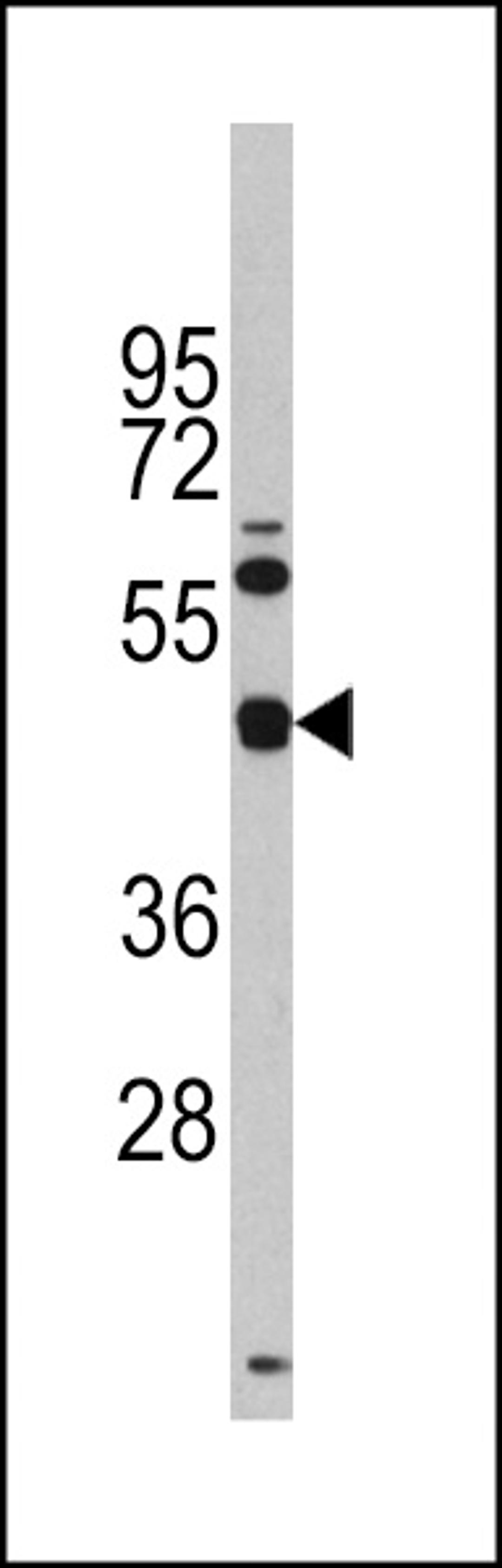 Western blot analysis of anti- in Y79 cell line lysates (35ug/lane).