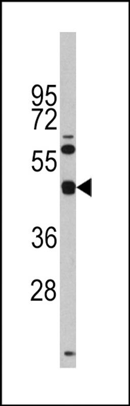 Western blot analysis of anti- in Y79 cell line lysates (35ug/lane).