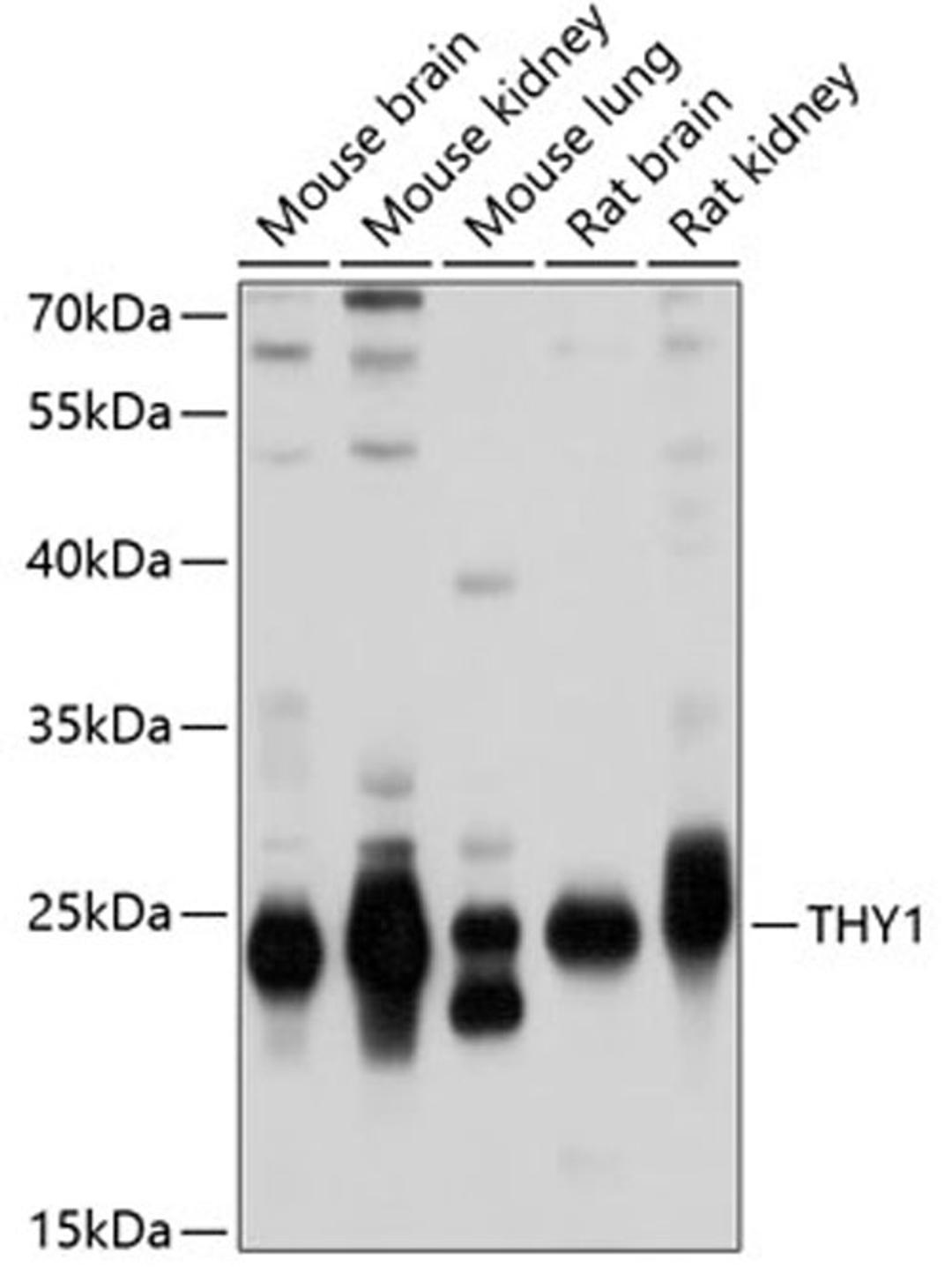 Western blot - THY1 antibody (A2126)