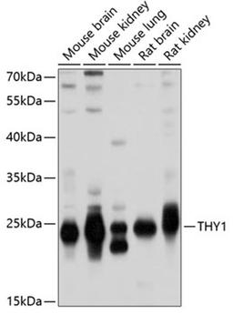 Western blot - THY1 antibody (A2126)