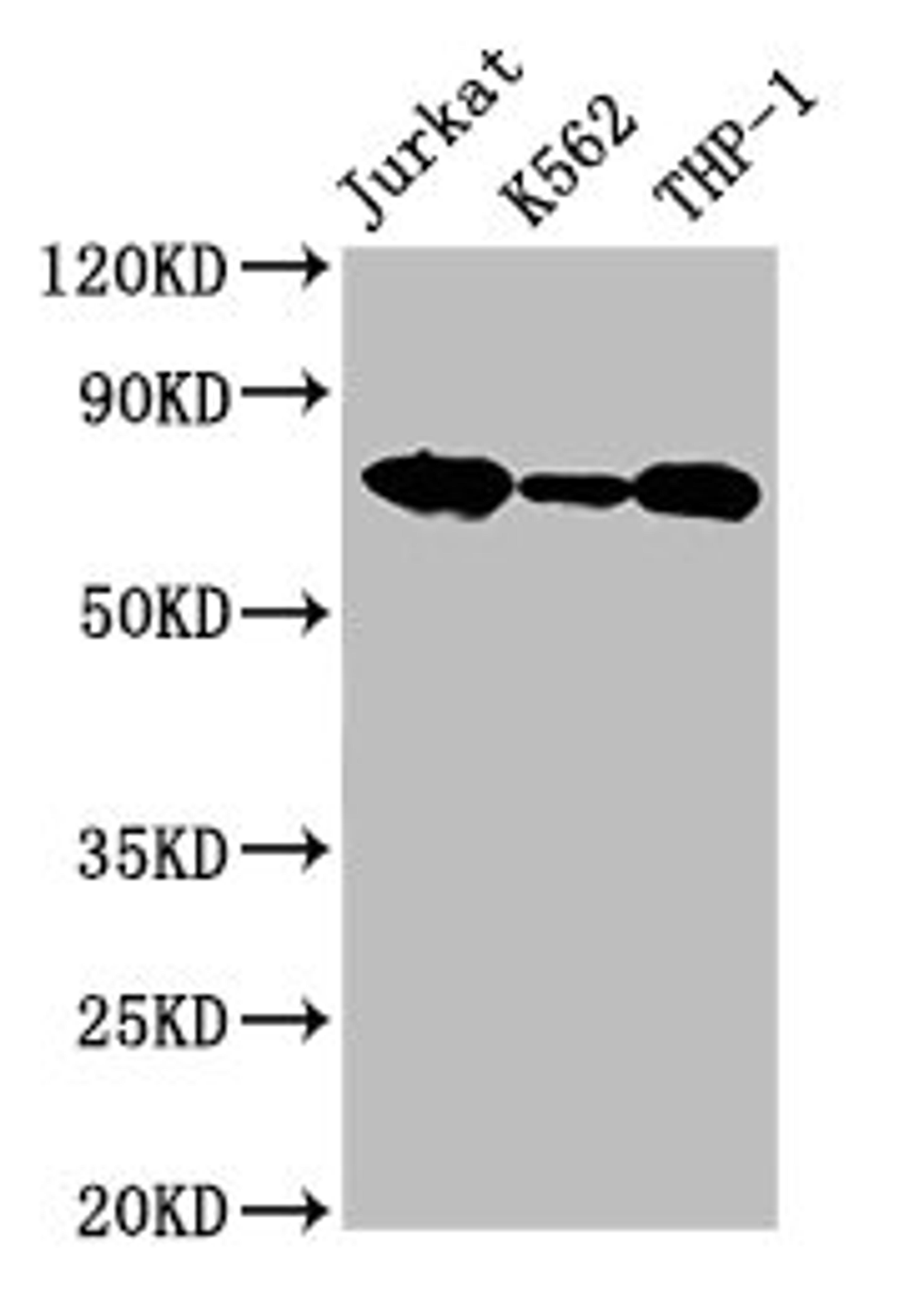 Western Blot. Positive WB detected in: Jurkat whole cell lysate, K562 whole cell lysate, THP-1 whole cell lysate. All lanes: LCP1 antibody at 2.6µg/ml. Secondary. Goat polyclonal to rabbit IgG at 1/50000 dilution. Predicted band size: 71, 22 kDa. Observed band size: 71 kDa
