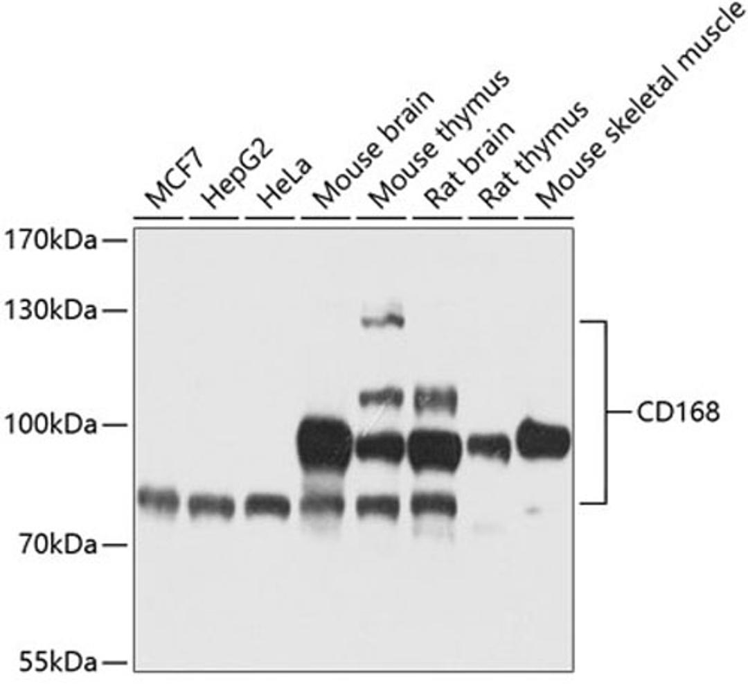 Western blot - CD168 antibody (A13315)