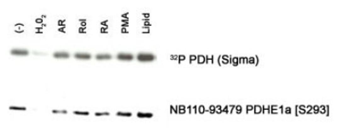 Western Blot: Pyruvate Dehydrogenase E1-alpha subunit [p Ser293] Antibody [NB110-93479] - Detection of PDHE1 alpha [S293] in an in vitro autophosphorylation of PDH complex in response to different stimulants: (-) none, H202-hydrogen peroxide, AR-anhydroretinol, Rol-retinol, RA-retinoic acid, PMA, Lipid-PKC lipid activator.  -Photo courtesy of Dr. Beatrice Hoyos, Memorial Sloan-Kettering Cancer Center.