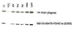 Western Blot: Pyruvate Dehydrogenase E1-alpha subunit [p Ser293] Antibody [NB110-93479] - Detection of PDHE1 alpha [S293] in an in vitro autophosphorylation of PDH complex in response to different stimulants: (-) none, H202-hydrogen peroxide, AR-anhydroretinol, Rol-retinol, RA-retinoic acid, PMA, Lipid-PKC lipid activator.  -Photo courtesy of Dr. Beatrice Hoyos, Memorial Sloan-Kettering Cancer Center.