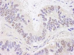 Detection of human BTF by immunohistochemistry.