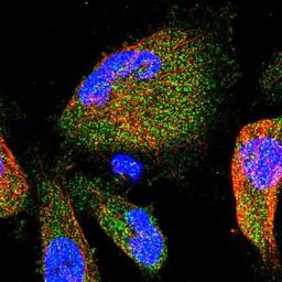 Immunocytochemistry/Immunofluorescence: CCDC78 Antibody [NBP1-88441] - Immunofluorescent staining of human cell line U-251 MG shows positivity in cytoplasm.