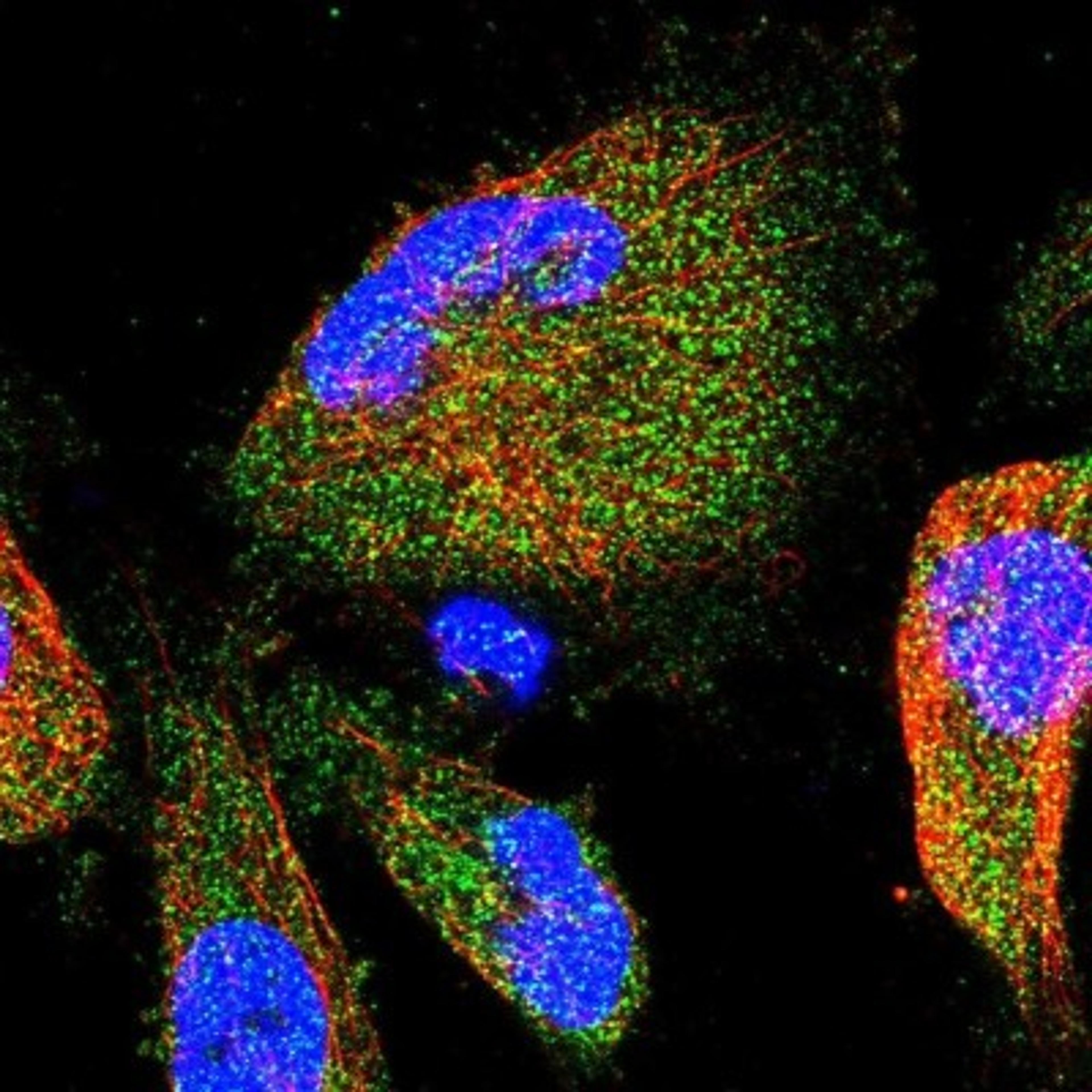 Immunocytochemistry/Immunofluorescence: CCDC78 Antibody [NBP1-88441] - Immunofluorescent staining of human cell line U-251 MG shows positivity in cytoplasm.