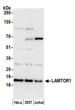 Detection of human LAMTOR1 by western blot.