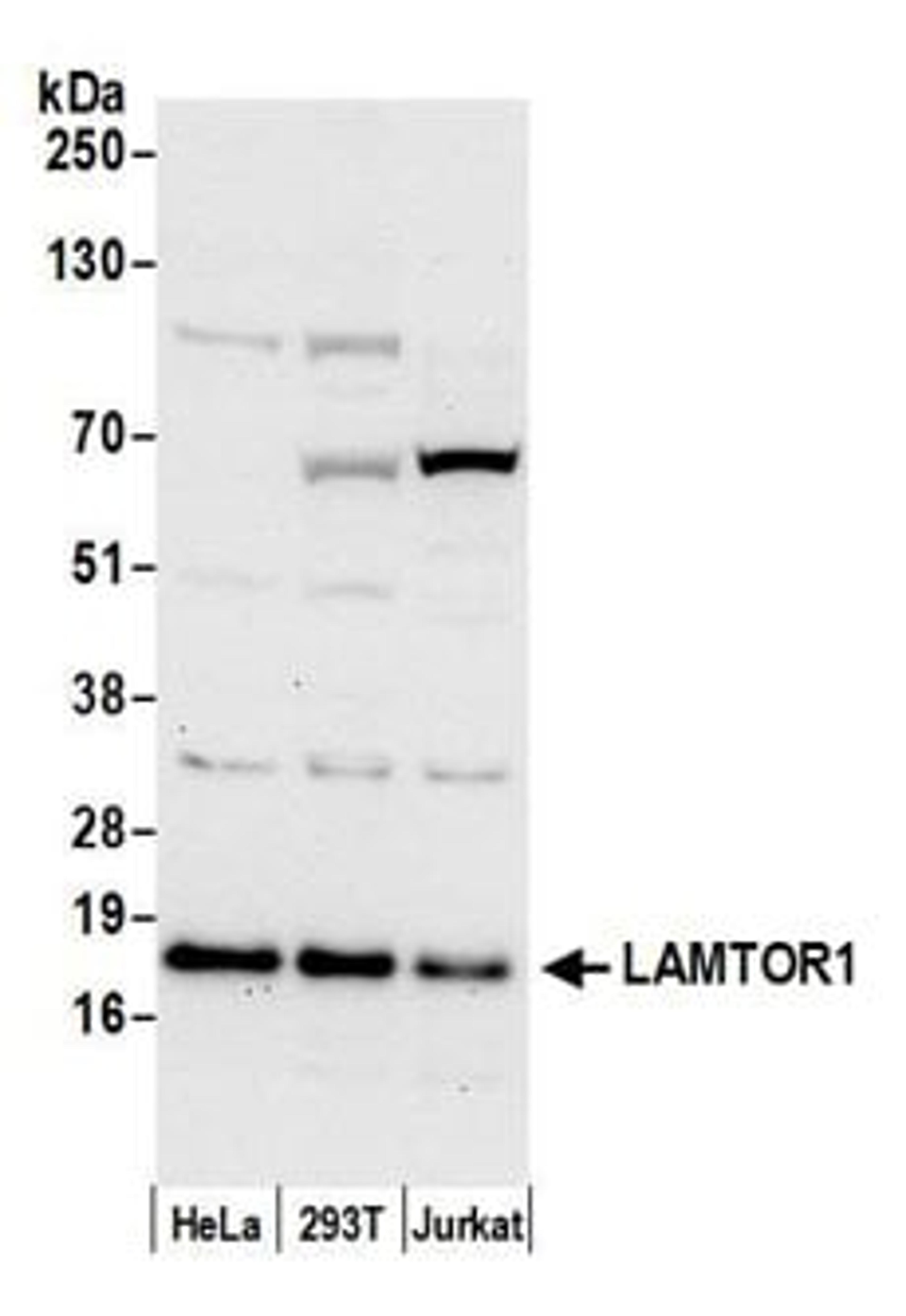 Detection of human LAMTOR1 by western blot.