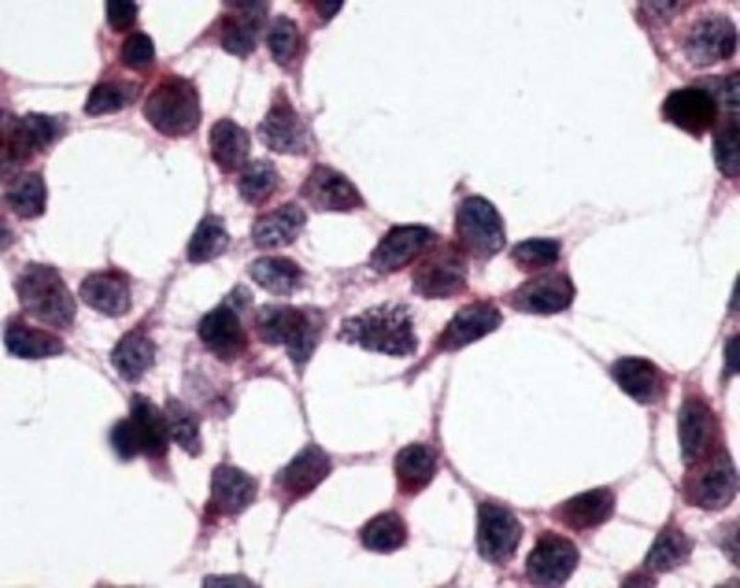 Immunohistochemistry-Paraffin: XPR1 Antibody [NBP2-29487] - Analysis of anti-XPR1 antibody with cells expressing vector only at 8 ug/ml.