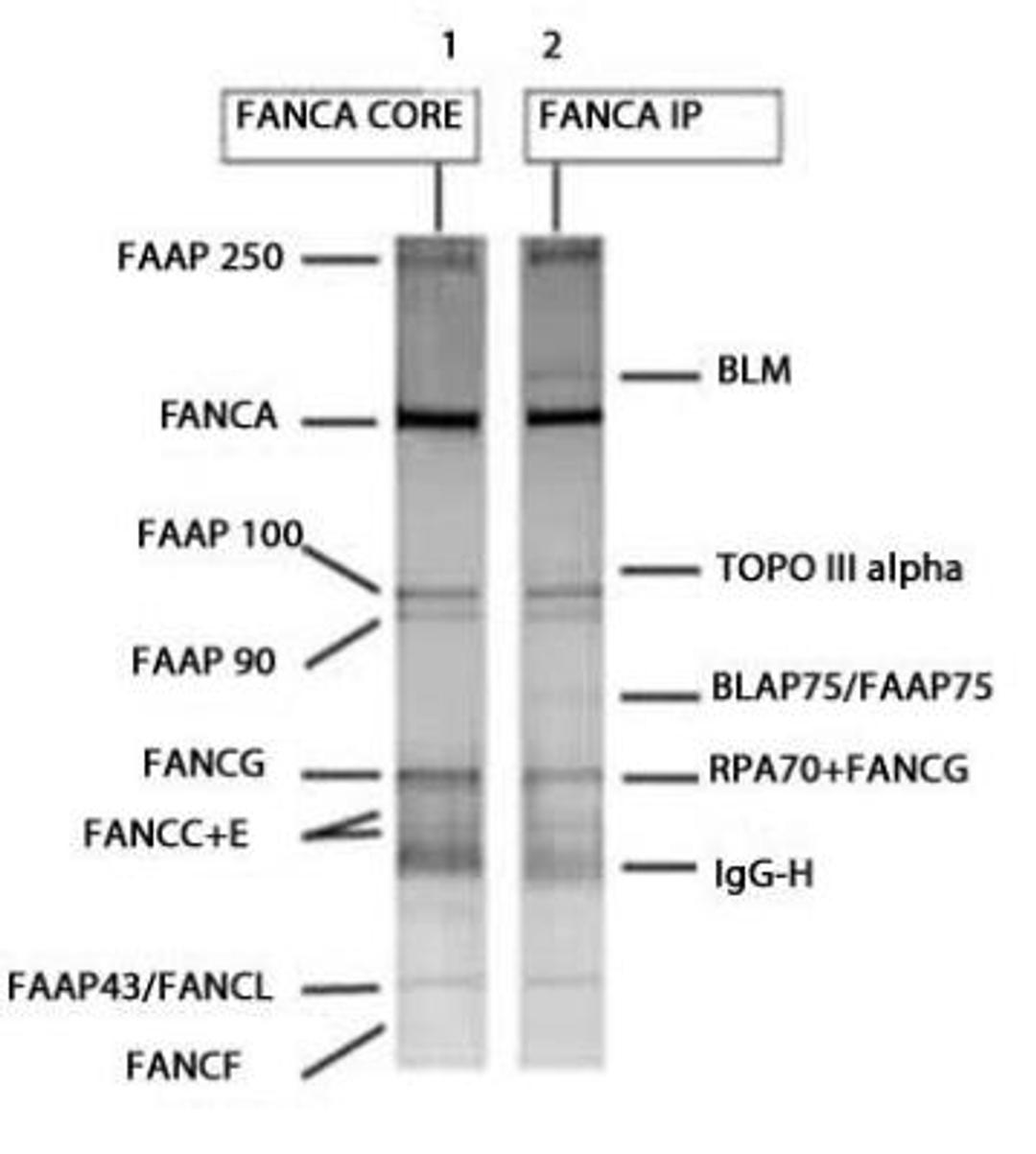 Immunoprecipitation: FACA/FANCA Antibody [NBP1-18977] - Lane 1: The Fanconi anemia core complex was obtained by IP from HeLa nuclear extracts with anti-FANCA under high stringency washing conditions, removing BLM, Topo III alpha, BLAP75 and RPA70 as indicated. L