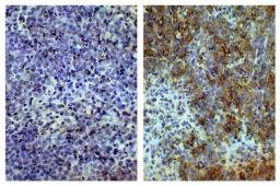 Paraffin embedded chicken spleen tissue was stained with Mouse Anti-Chicken CD8?-UNLB (Cat. No. 99-212; right) followed by Anti-Mouse IgG-HRP and DAB.