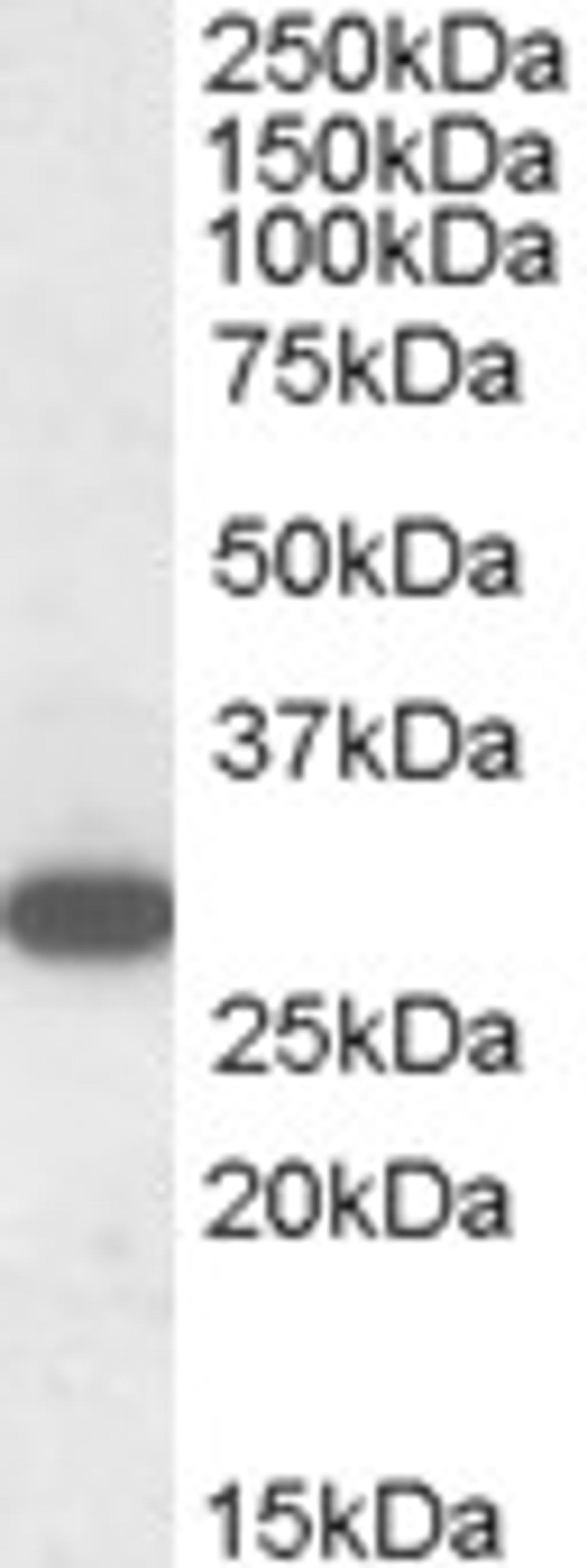 46-290 (1ug/ml) staining of Human Peripheral Blood Mononucleocytes lysate (35ug protein in RIPA buffer). Primary incubation was 1 hour. Detected by chemiluminescence.