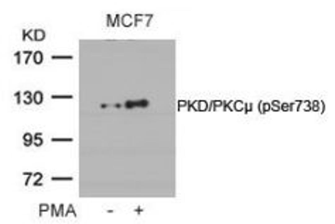 Western blot analysis of lysed extracts from MCF cells untreated or treated with PMA using PKD/PKC&#956; (Phospho-Ser738).