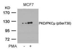 Western blot analysis of lysed extracts from MCF cells untreated or treated with PMA using PKD/PKC&#956; (Phospho-Ser738).