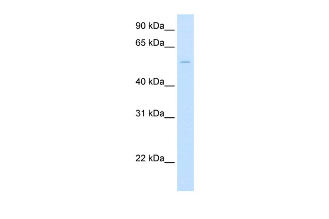 Antibody used in WB on Human Liver at 2.5 ug/ml.