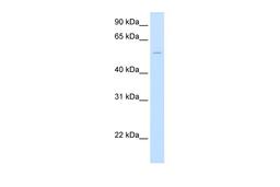 Antibody used in WB on Human Liver at 2.5 ug/ml.