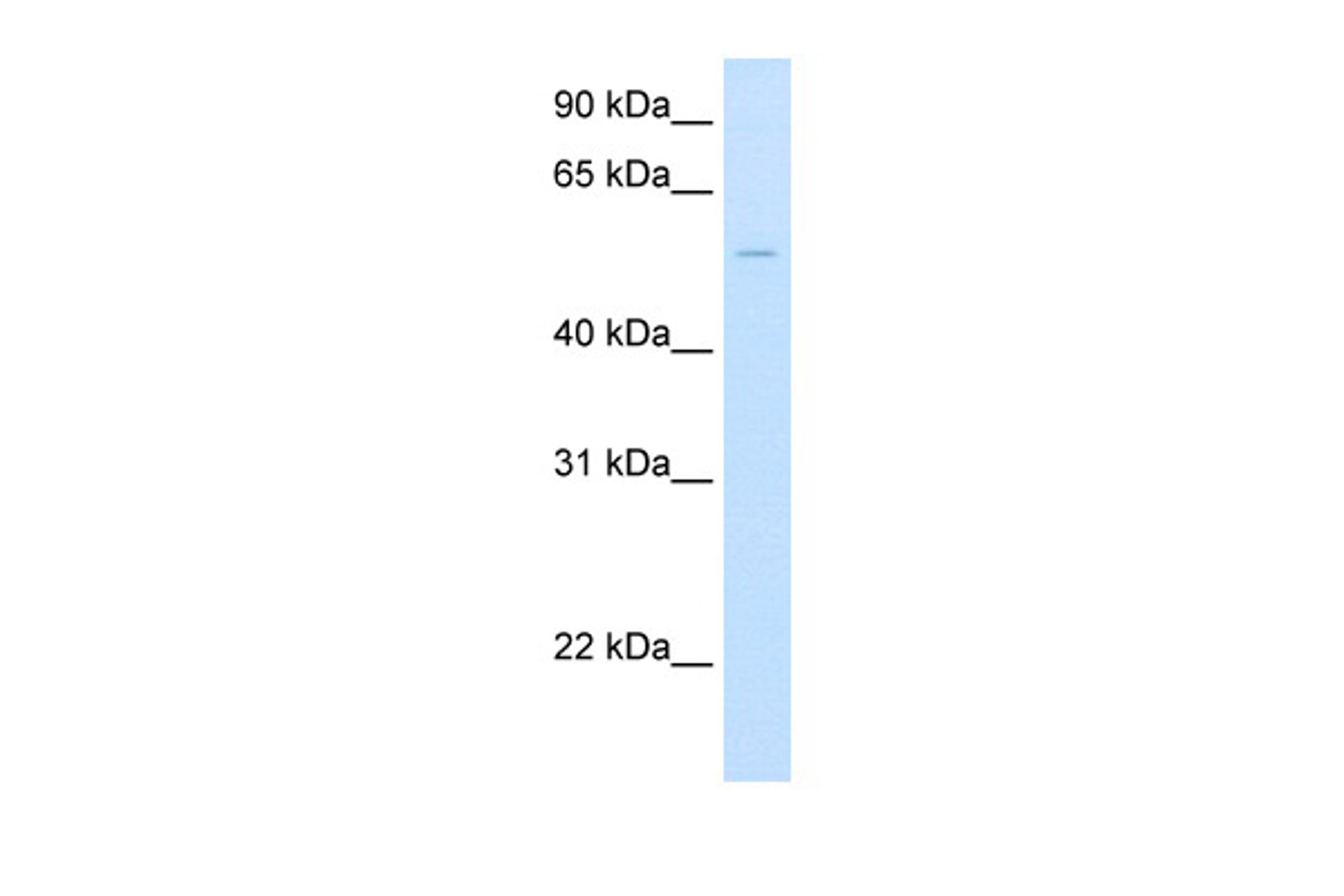 Antibody used in WB on Human Liver at 2.5 ug/ml.