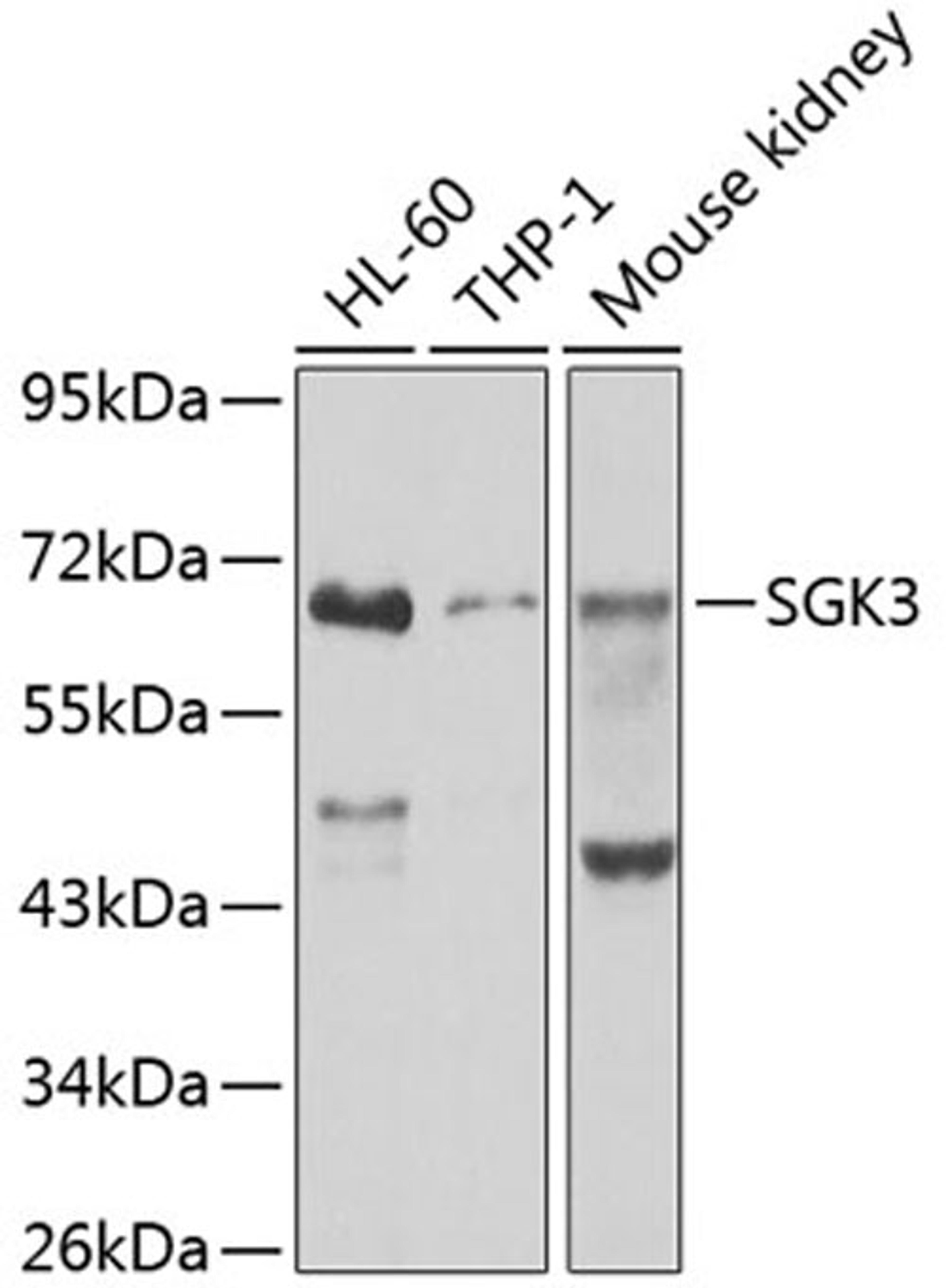 Western blot - SGK3 antibody (A7586)