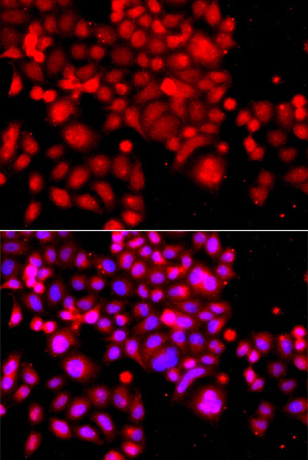 Immunofluorescence - ASCC3 antibody (A7960)