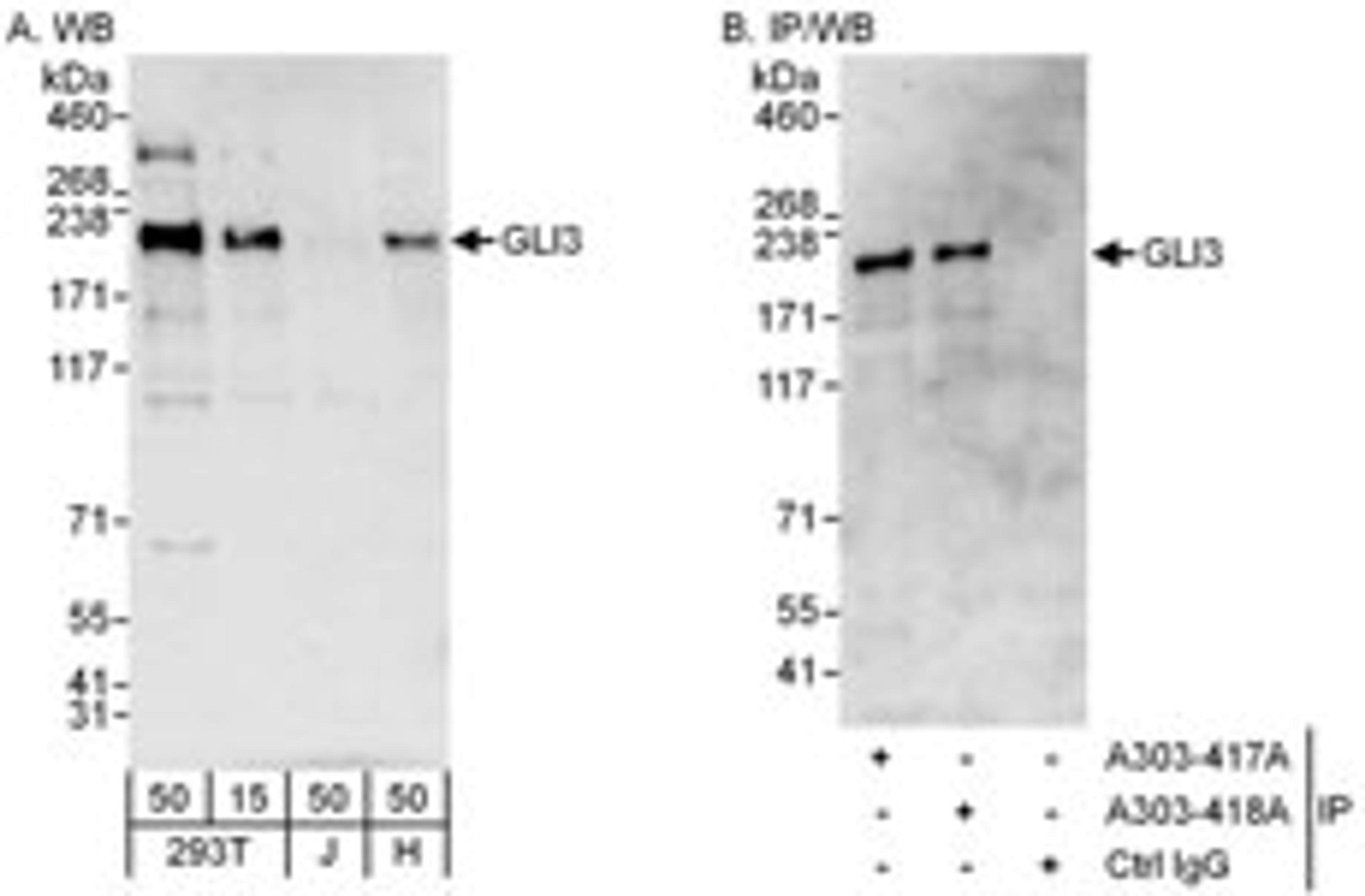 Detection of human GLI3 by western blot and immunoprecipitation.