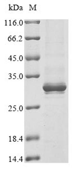 (Tris-Glycine gel) Discontinuous SDS-PAGE (reduced) with 5% enrichment gel and 15% separation gel.
