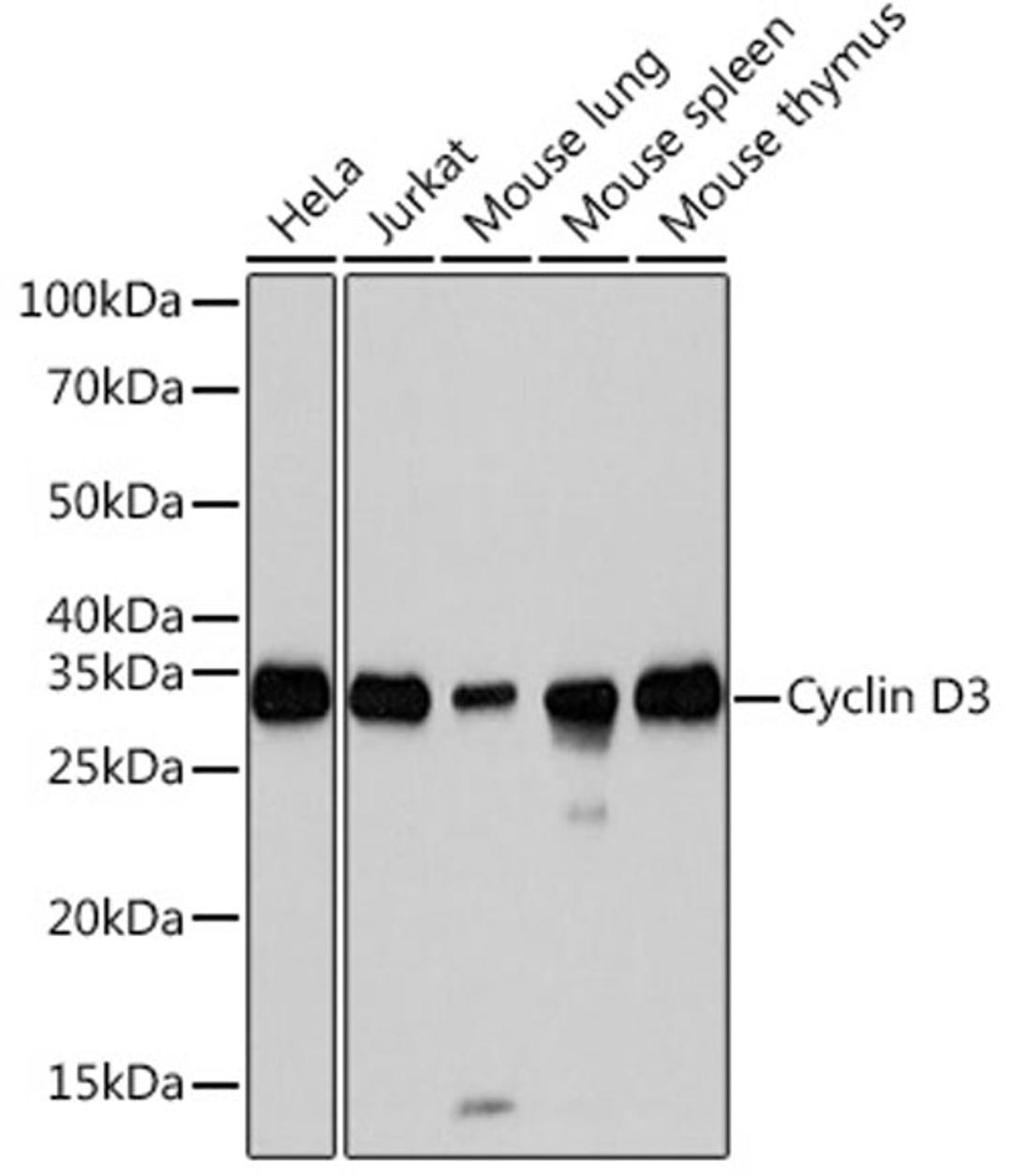 Western blot - Cyclin D3 Rabbit mAb (A3989)