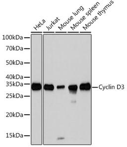 Western blot - Cyclin D3 Rabbit mAb (A3989)