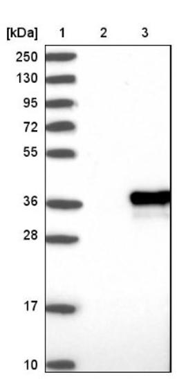 Western Blot: ZCCHC9 Antibody [NBP1-84102] - Lane 1: Marker [kDa] 250, 130, 95, 72, 55, 36, 28, 17, 10<br/>Lane 2: Negative control (vector only transfected HEK293T lysate)<br/>Lane 3: Over-expression lysate (Co-expressed with a C-terminal myc-DDK tag (~3.1 kDa) in mammalian HEK293T cells, LY410224)