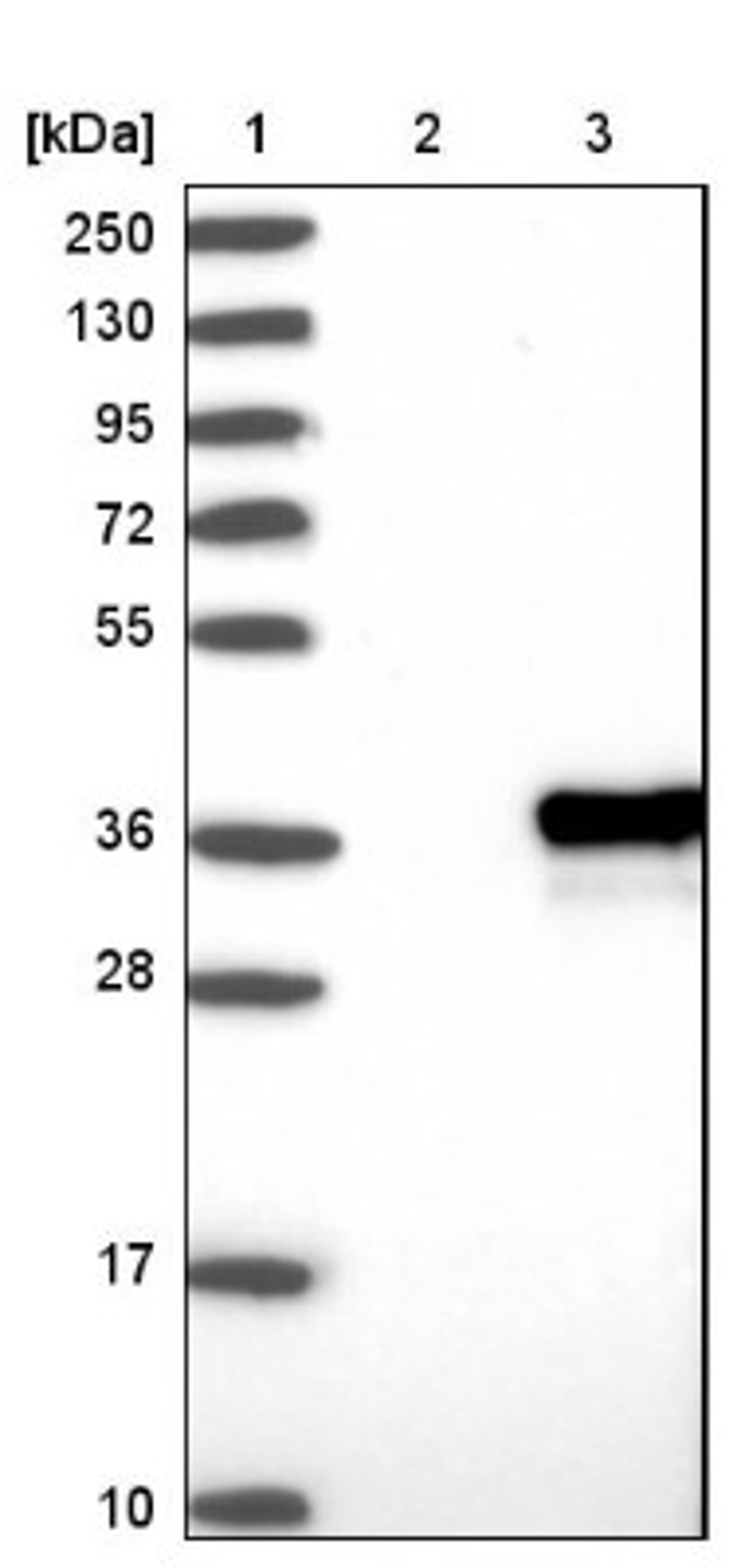 Western Blot: ZCCHC9 Antibody [NBP1-84102] - Lane 1: Marker [kDa] 250, 130, 95, 72, 55, 36, 28, 17, 10<br/>Lane 2: Negative control (vector only transfected HEK293T lysate)<br/>Lane 3: Over-expression lysate (Co-expressed with a C-terminal myc-DDK tag (~3.1 kDa) in mammalian HEK293T cells, LY410224)