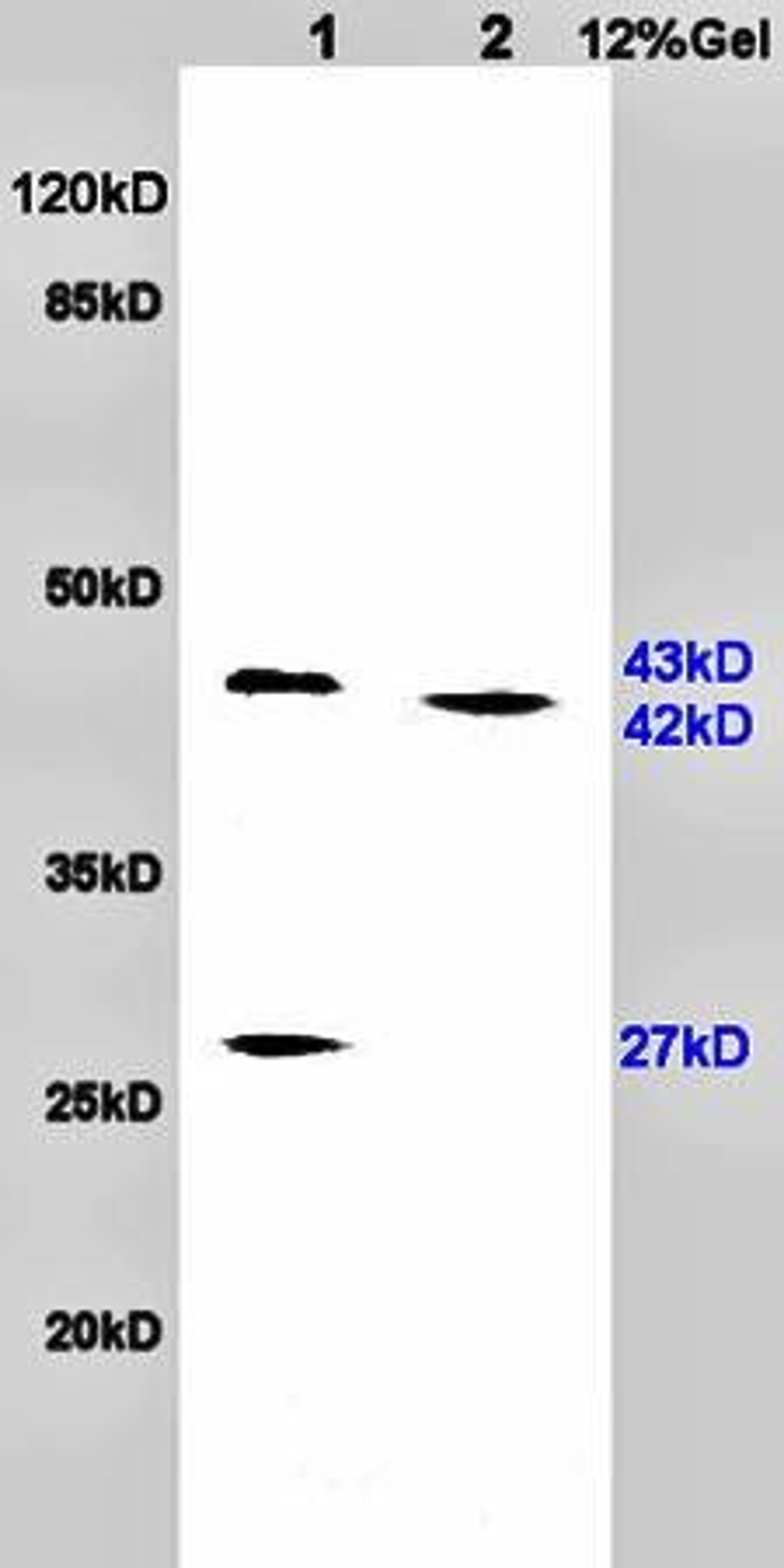 Western blot analysis of rat brain lysates(Lane1),rat heart lysates(Lane2) using PACAP 38 antibody