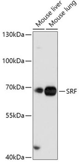 Western blot - SRF antibody (A16718)