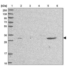 Western Blot: PSMA8 Antibody [NBP2-31889] - Lane 1: Marker [kDa] 250, 130, 95, 72, 55, 36, 28, 17, 10<br/>Lane 2: Human cell line RT-4<br/>Lane 3: Human cell line U-251MG sp<br/>Lane 4: Human plasma (IgG/HSA depleted)<br/>Lane 5: Human liver tissue<br/>Lane 6: Human tonsil tissue