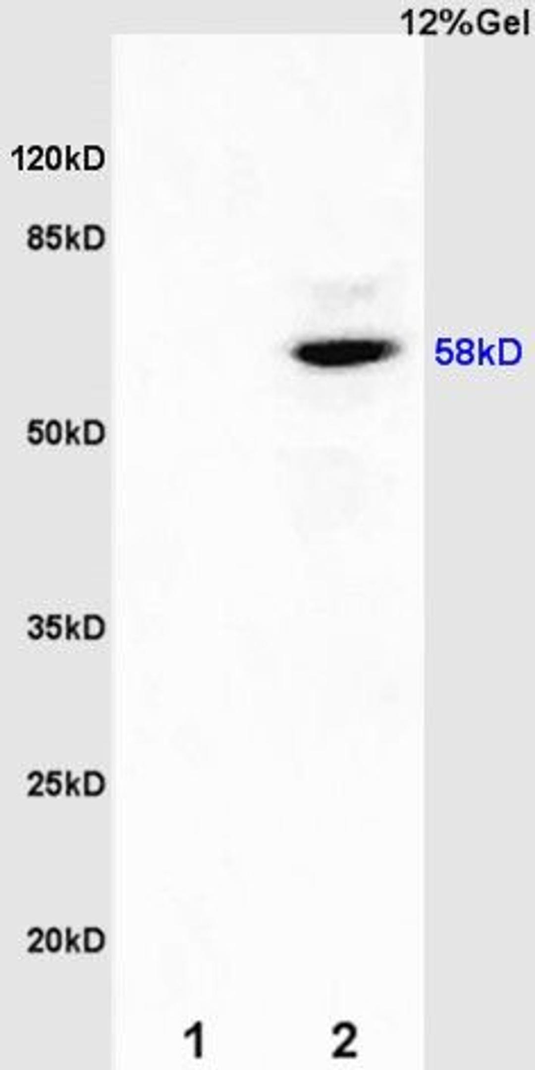 Western blot analysis of rat kidney lysates(Lane 1), rat brain lysates (Lane2) using Estrogen Recepter beta antibody