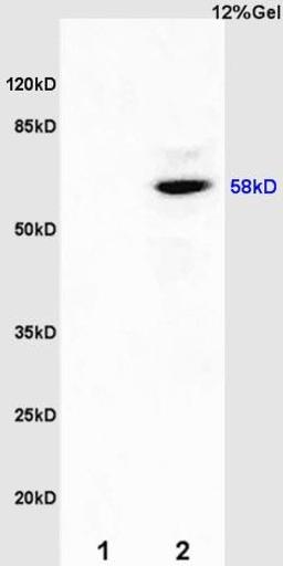 Western blot analysis of rat kidney lysates(Lane 1), rat brain lysates (Lane2) using Estrogen Recepter beta antibody