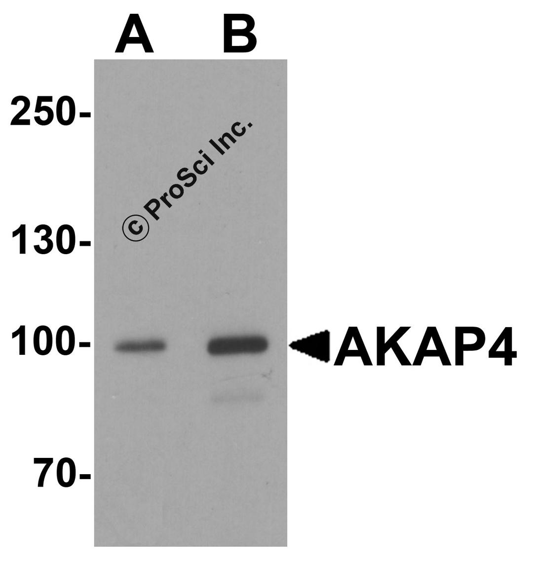 Western blot analysis of AKAP4 in human testis tissue lysate with AKAP4 antibody at (A) 1 and (B) 2 μg/ml.