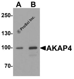 Western blot analysis of AKAP4 in human testis tissue lysate with AKAP4 antibody at (A) 1 and (B) 2 μg/ml.