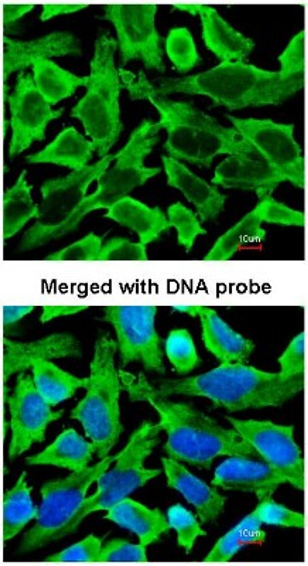 Immunocytochemistry/Immunofluorescence: RPS10 Antibody [NBP1-31357] - Analysis of HeLa, using NBP1-31357 at 1:200 dilution.