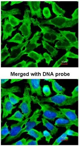 Immunocytochemistry/Immunofluorescence: RPS10 Antibody [NBP1-31357] - Analysis of HeLa, using NBP1-31357 at 1:200 dilution.