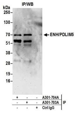 Detection of human ENH/PDLIM5 by western blot of immunoprecipitates.