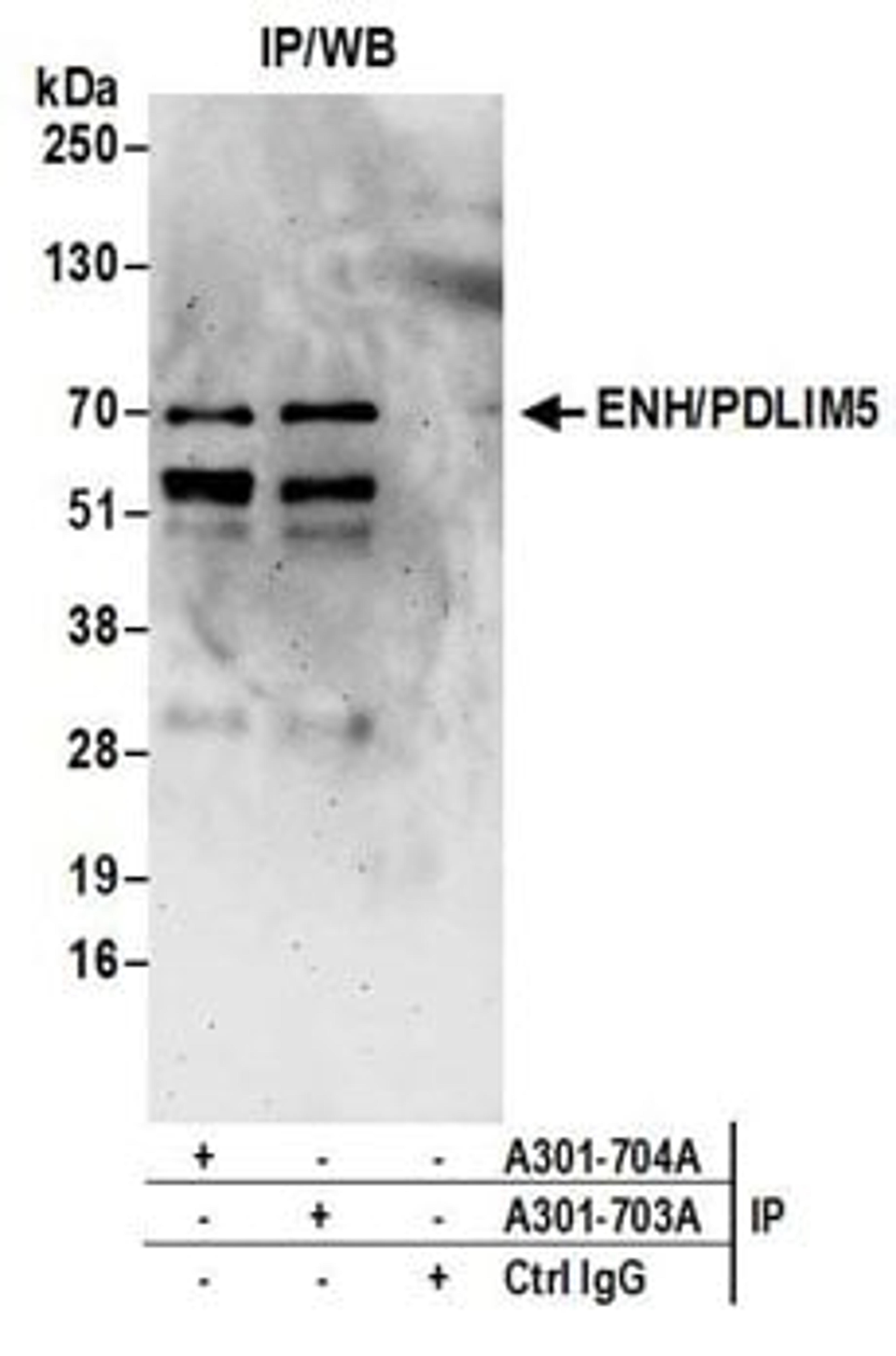 Detection of human ENH/PDLIM5 by western blot of immunoprecipitates.