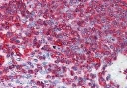 Immunohistochemistry-Paraffin: GDI2 Antibody [NBP1-52317] - Analysis of anti-GDI2 antibody with human spleen at concentration 10 ug/ml.